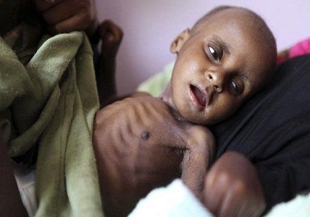 UNICEF UYARDI: YEMENLİ ÇOCUKLAR YARDIM BEKLİYOR